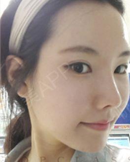 娛樂吃瓜醬不用做鼻子,揭秘明星隱私，不做鼻子也能暢游娛樂圈